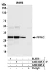 Detection of human PPP6C by western blot of immunoprecipitates.
