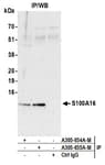 Detection of human S100A16 by western blot of immunoprecipitates.