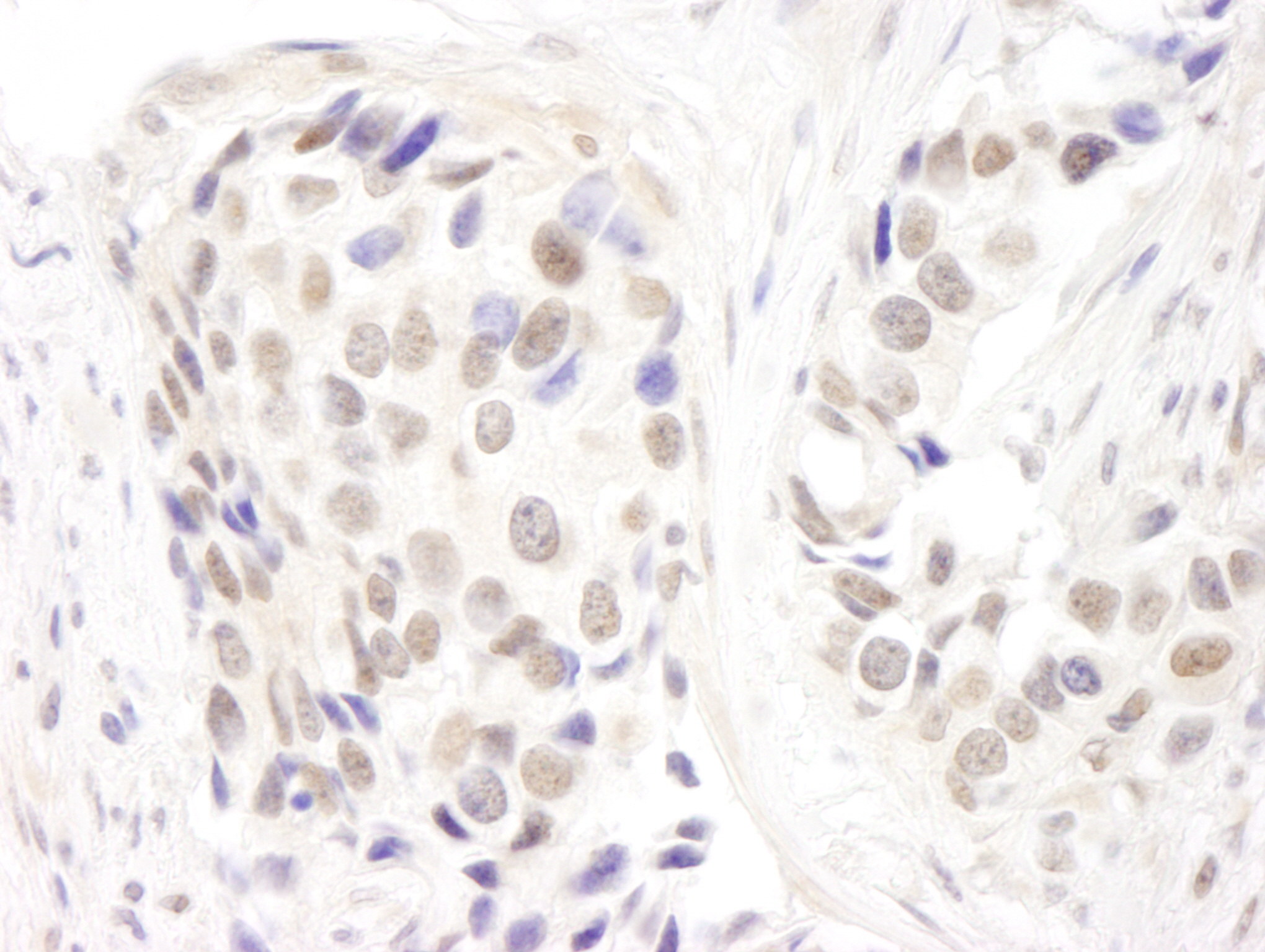 Rabbit anti-p66alpha IHC Antibody