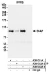 Detection of human E6AP by western blot of immunoprecipitates.