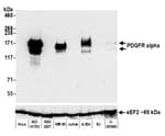 Detection of human PDGFR alpha by western blot.
