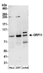 Detection of human ORP11 by western blot.