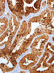 Detection of human MUC1/EMA by immunohistochemistry.