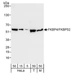 Detection of human and mouse FKBP4/FKBP52 by western blot.