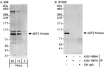 Detection of human eEF2 Kinase by western blot and immunoprecipitation.