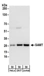 Detection of human GAMT by western blot.