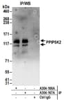 Detection of human PPIP5K2 by western blot of immunoprecipitates.