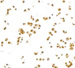 Detection of human PAX8 by immunocytochemistry.