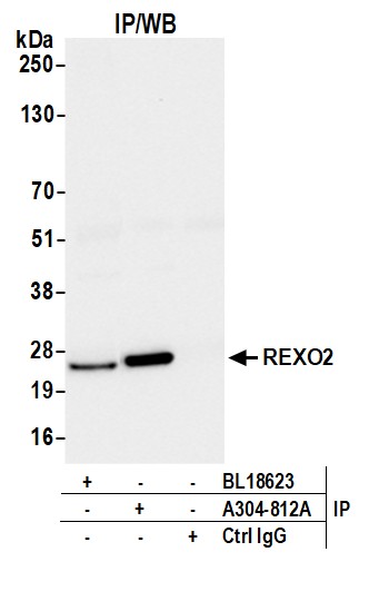Detection of human REXO2 by western blot of immunoprecipitates.