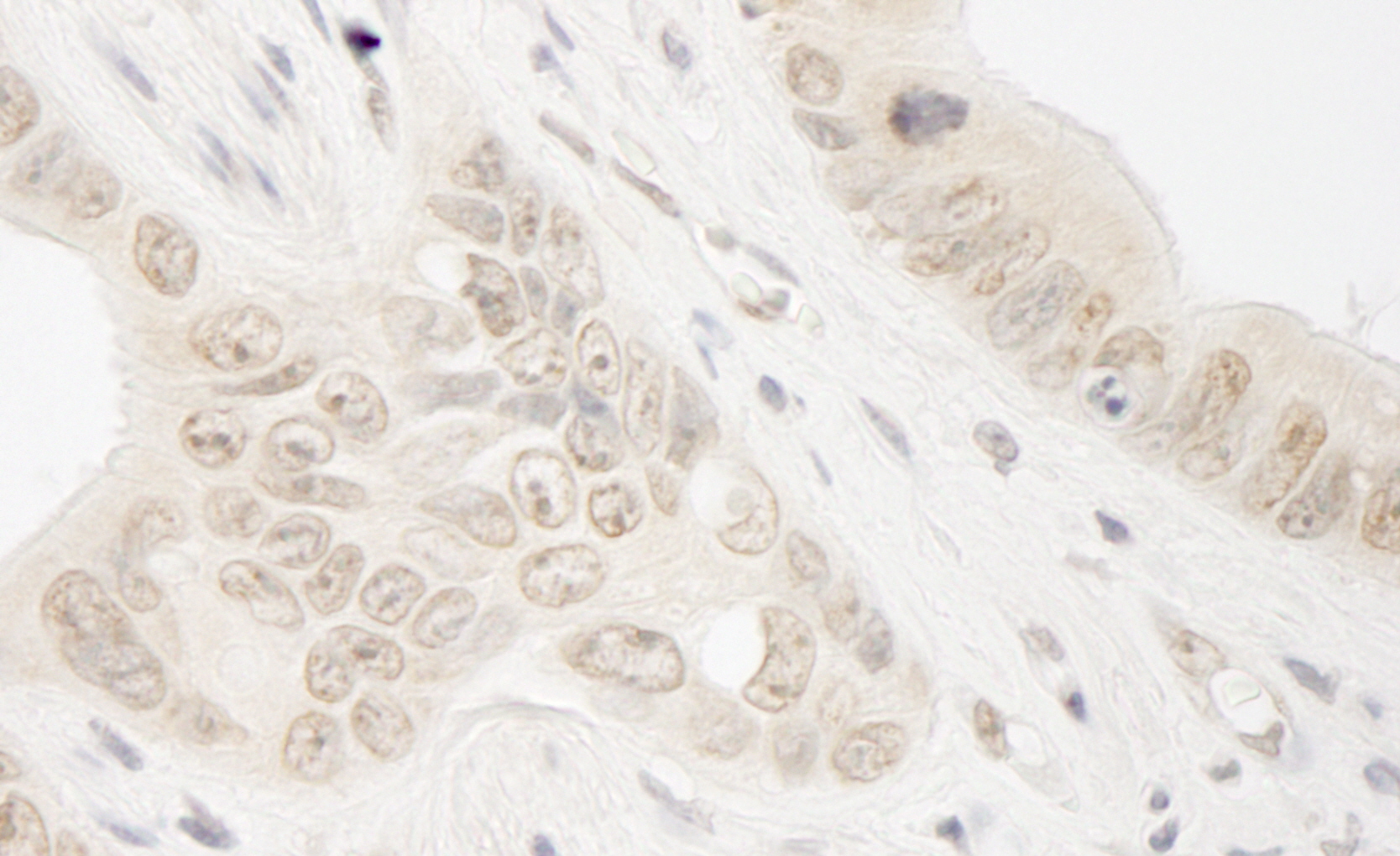 Rabbit anti-ARIP4 IHC Antibody