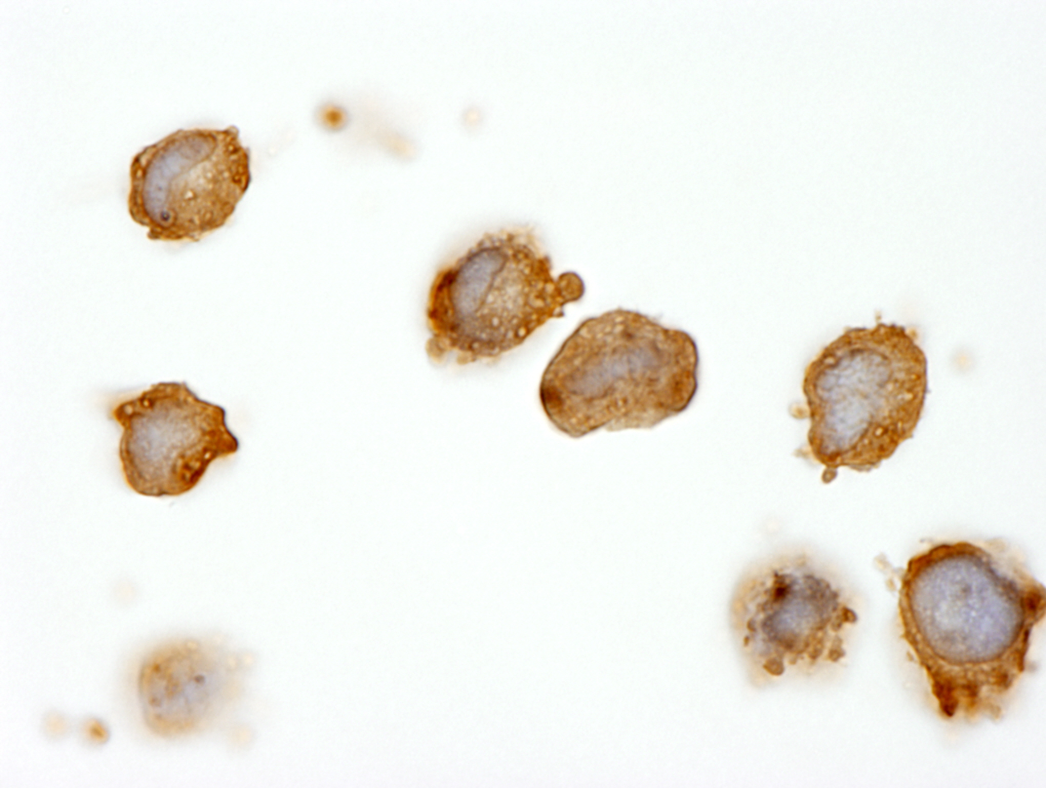 Rabbit anti-BCR IHC Antibody