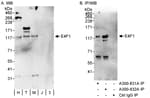 Detection of human E4F1 by western blot and immunoprecipitation.