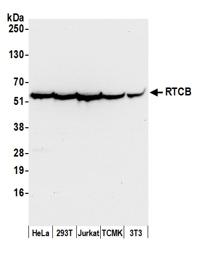 Detection of human and mouse RTCB by western blot.