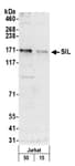 Detection of human SIL by western blot.