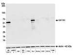 Detection of mouse GATA3 by western blot.