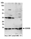 Detection of human and mouse COX5B by western blot.