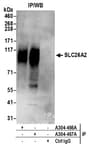 Detection of human SLC26A2 by western blot of immunoprecipitates.
