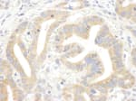Detection of human IP3R3 by immunohistochemistry.