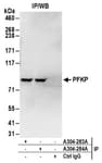 Detection of human PFKP by western blot of immunoprecipitates.