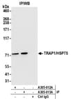 Detection of human TRAP1/HSP75 by western blot of immunoprecipitates.