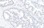 Detection of human DHX9 by immunohistochemistry.