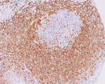 Detection of human Bcl-2 by immunohistochemistry.