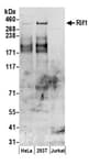 Detection of human Rif1 by western blot.