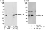 Detection of human and mouse BRCC36 by western blot (h&amp;m) and immunoprecipitation (h).