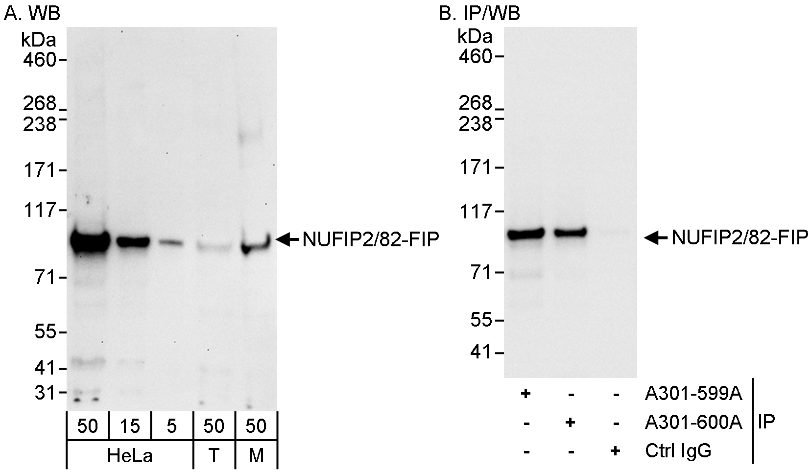 Detection of human and mouse NUFIP2/82-FIP by western blot (h&amp;m) and immunoprecipitation (h).