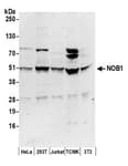 Detection of human and mouse NOB1 by western blot.