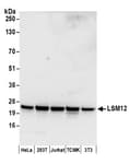 Detection of human and mouse LSM12 by western blot.