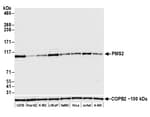 Detection of human PMS2 by western blot.