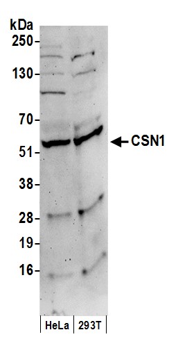 Detection of human CSN1 by immunohistochemistry.