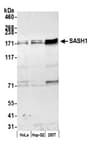 Detection of human SASH1 by western blot.