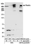 Detection of human and mouse Plectin by western blot.