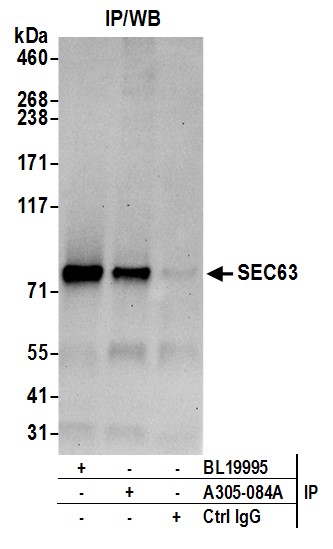 Detection of human SEC63 by western blot of immunoprecipitates.
