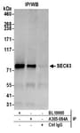Detection of human SEC63 by western blot of immunoprecipitates.