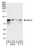 Detection of human MCAK by western blot.