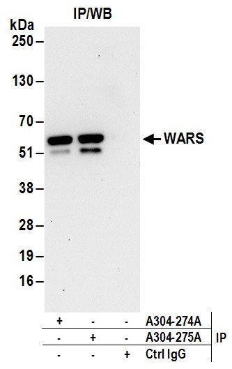Detection of human WARS by western blot of immunoprecipitates.