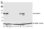 Detection of mouse N-Cadherin by western blot.