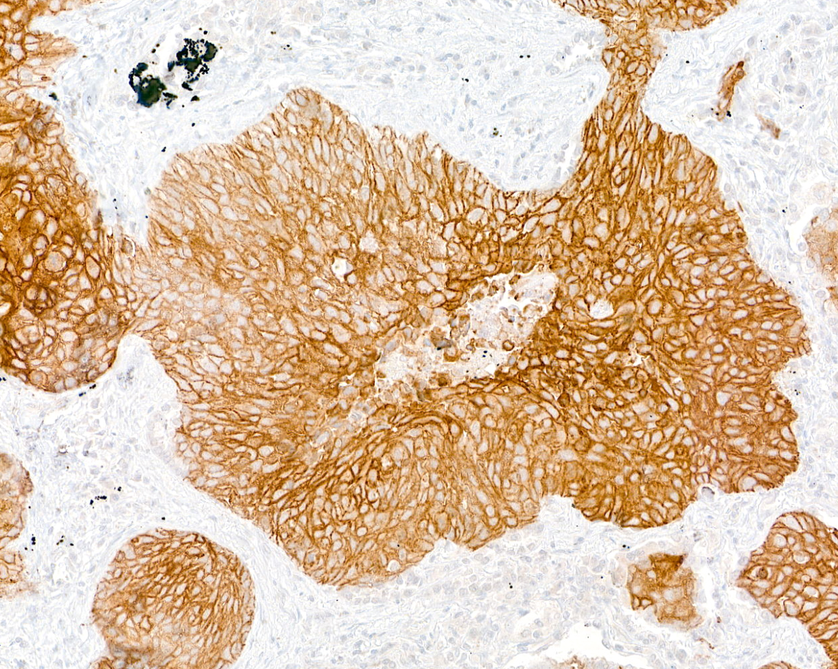 Detection of human Desmoglein 3 by immunohistochemistry.