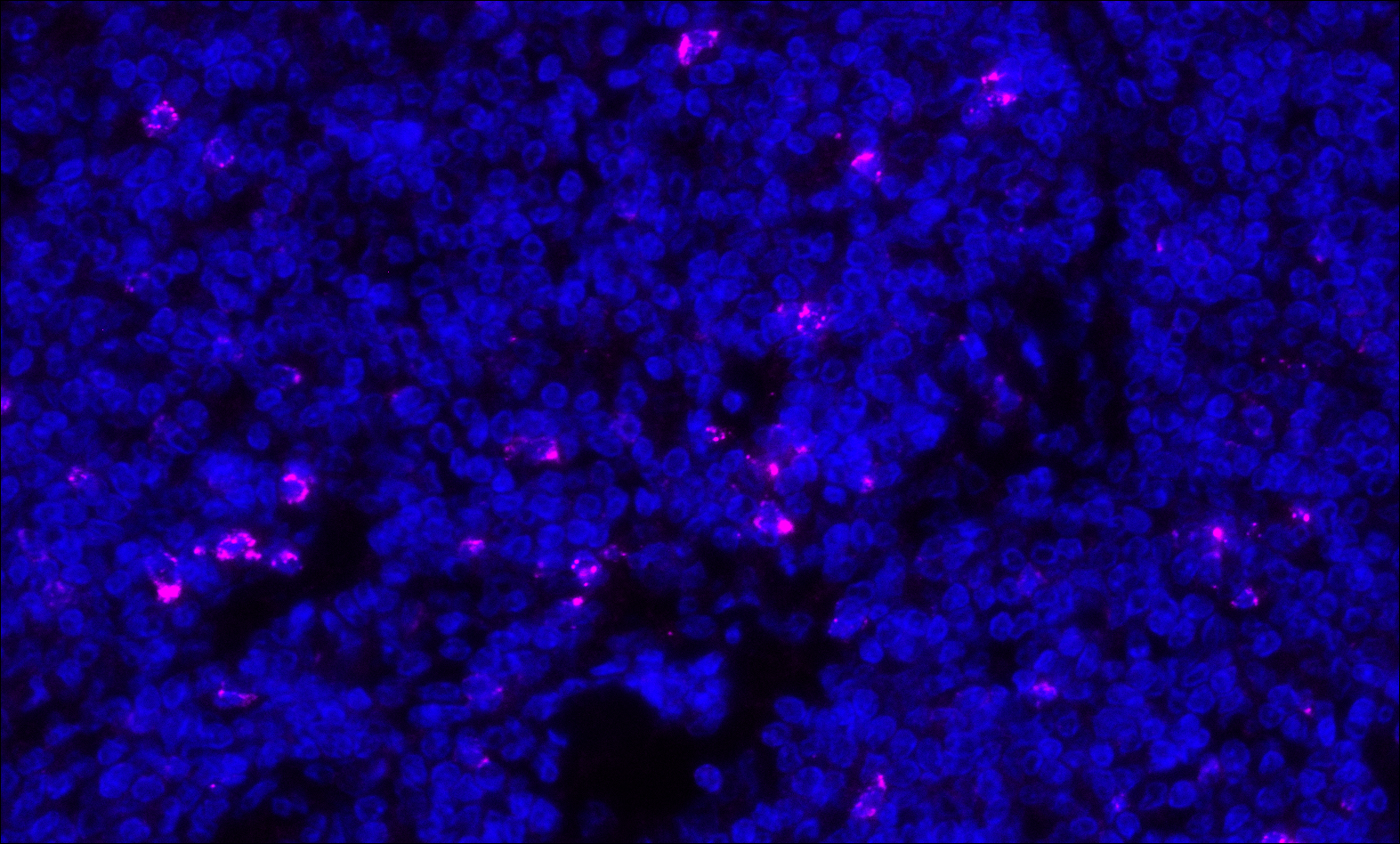Detection of human CTLA4 (magenta) by immunofluorescence.