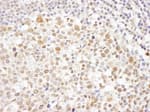 Detection of human Caf1p150 by immunohistochemistry.