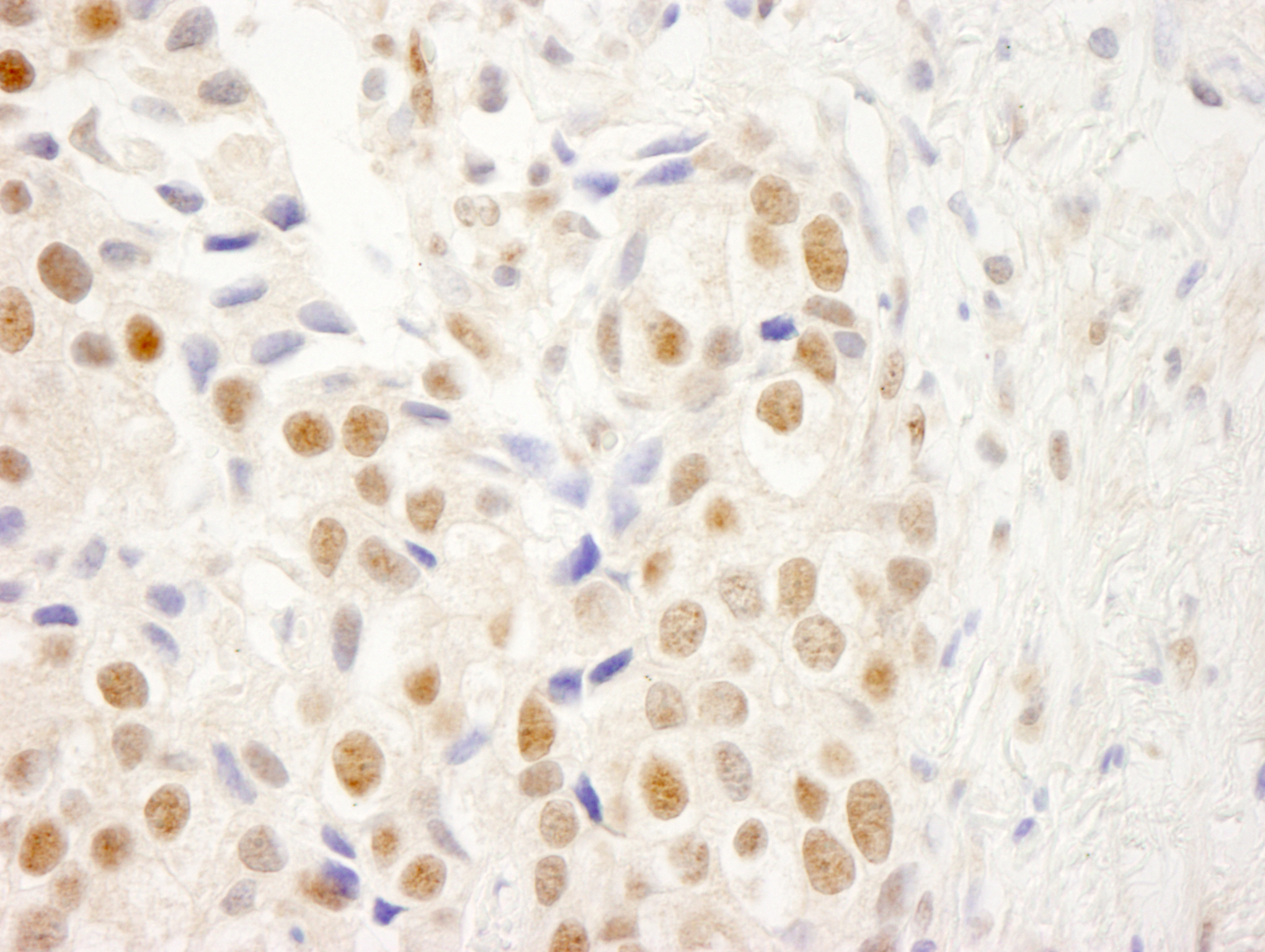 Rabbit anti-NRBF2 IHC Antibody