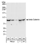 Detection of human and mouse beta Catenin by western blot.