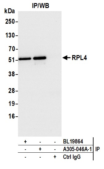 Detection of human RPL4 by western blot of immunoprecipitates.