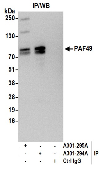 Detection of human PAF49 by western blot of immunoprecipitates.