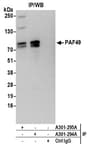 Detection of human PAF49 by western blot of immunoprecipitates.