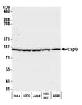 Detection of human CapG by western blot.