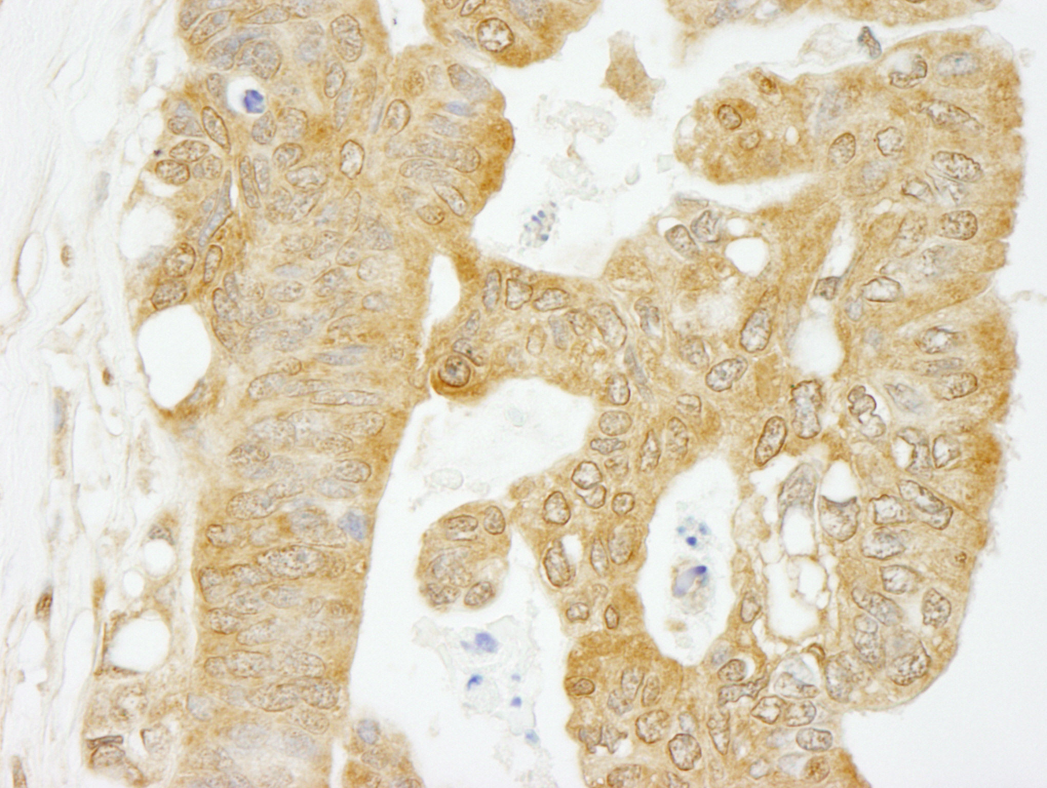 Rabbit anti-eIF4G1/eIF4GI IHC Antibody